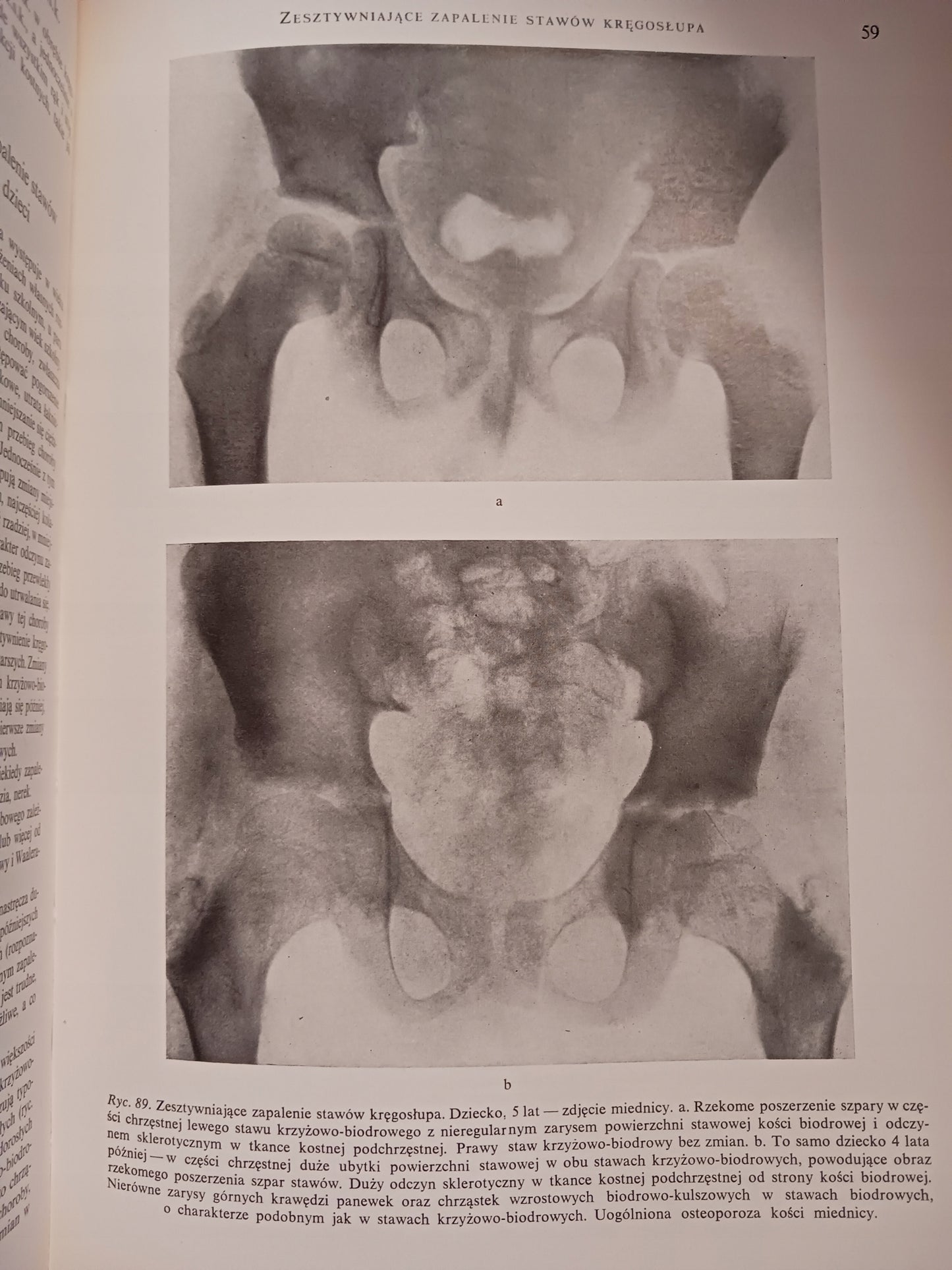 Atlas anatomii rentgenowskiej człowieka Bohdan Daniel + Atlas chorób...