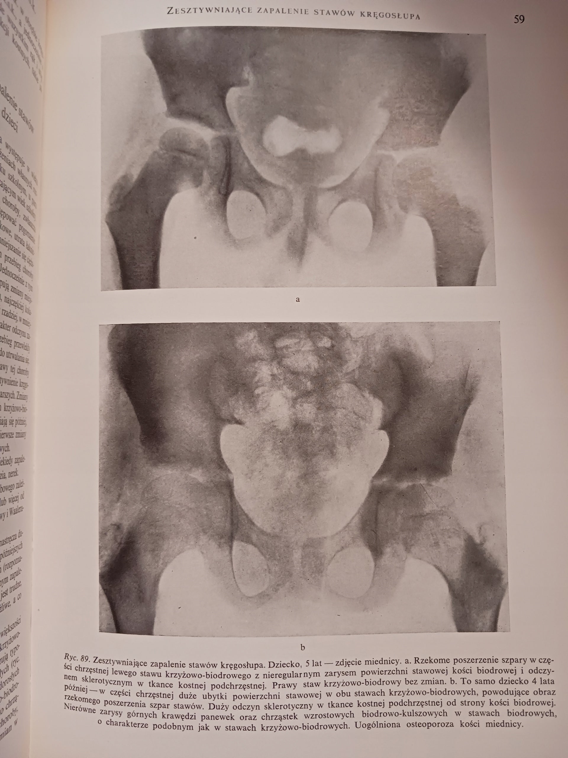 Atlas anatomii rentgenowskiej człowieka Bohdan Daniel + Atlas chorób...