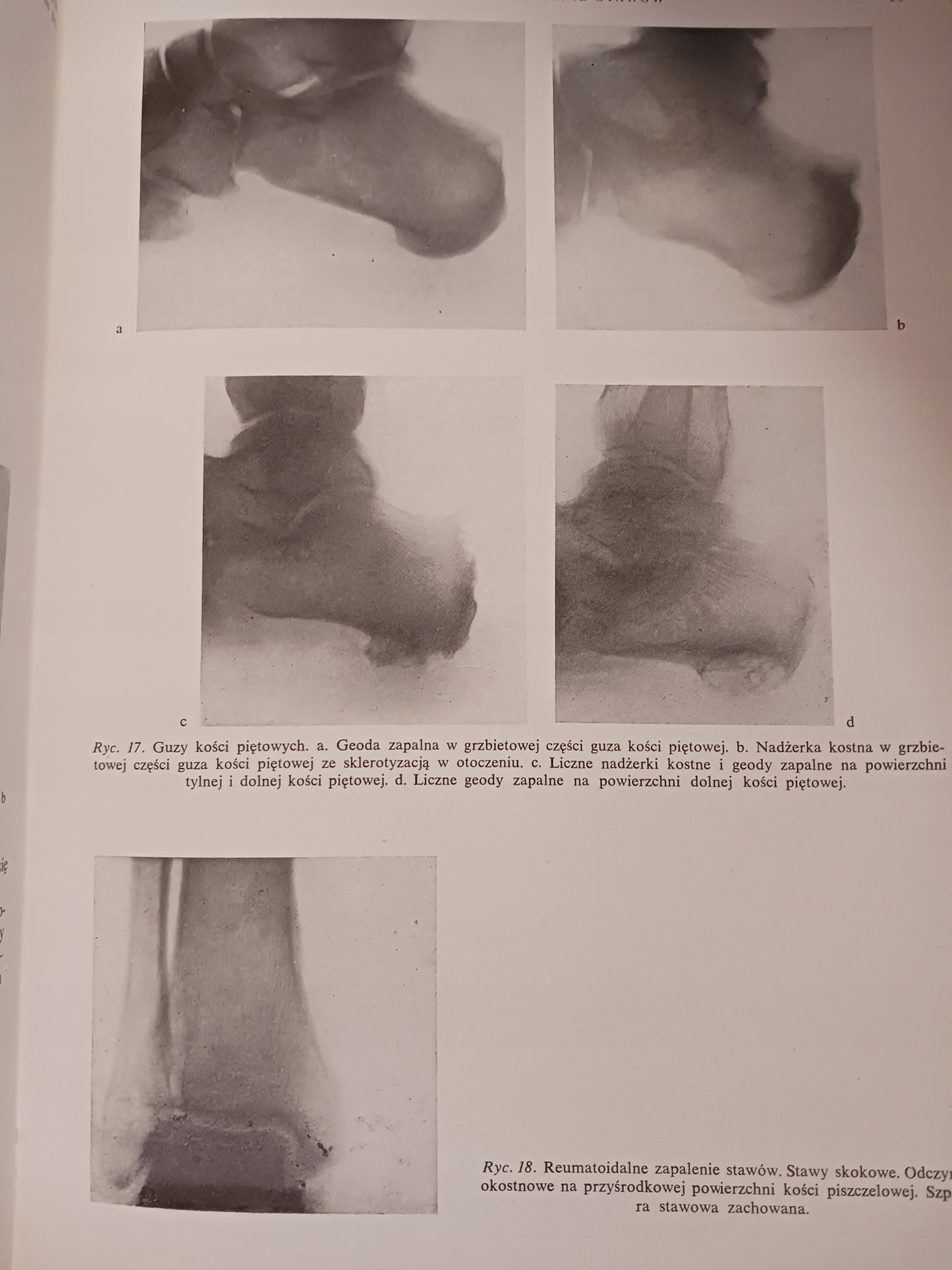 Atlas anatomii rentgenowskiej człowieka Bohdan Daniel + Atlas chorób...