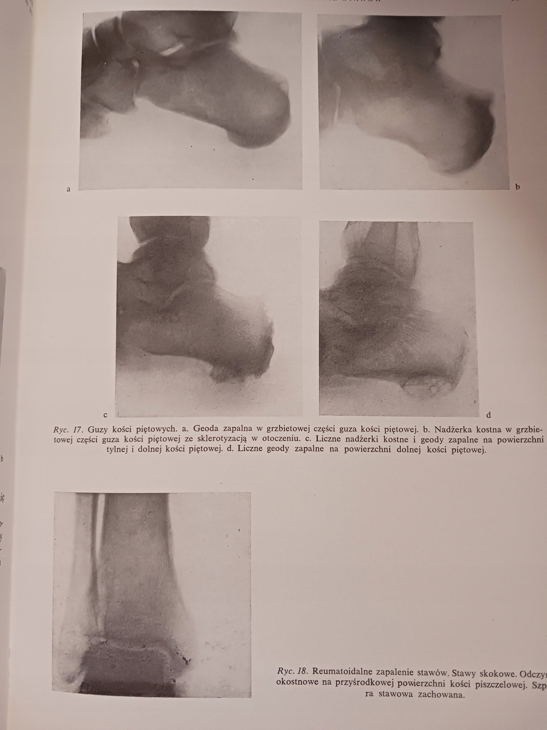 Atlas anatomii rentgenowskiej człowieka Bohdan Daniel + Atlas chorób...