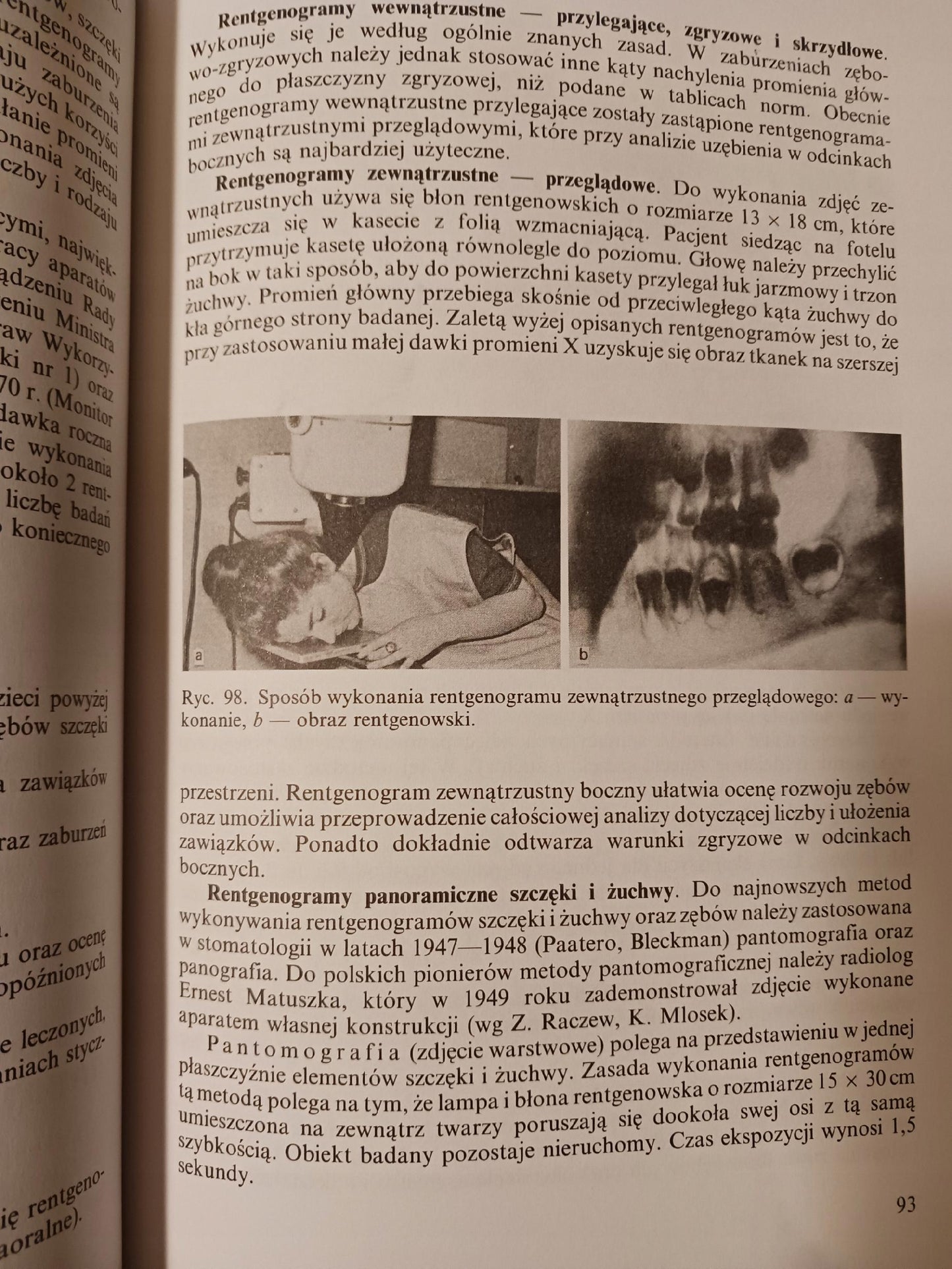 Ortopedia szczękowa. Zasady i praktyka. Podręcznik dla studentów P.zbiorowa