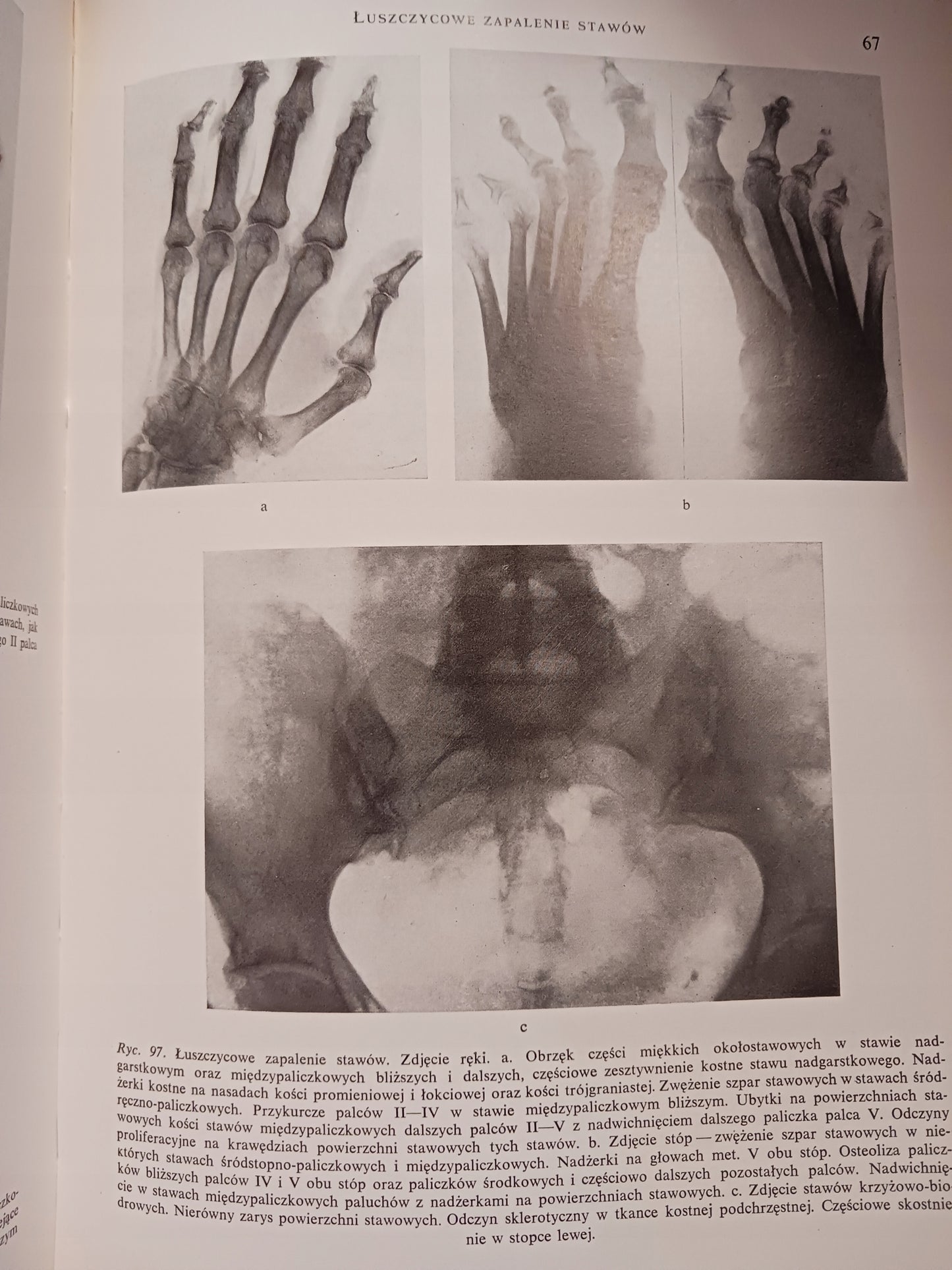 Atlas anatomii rentgenowskiej człowieka Bohdan Daniel + Atlas chorób...